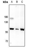 Anti-MERTK/TYRO3 Antibody