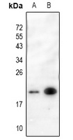p19 INK4d antibody