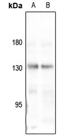 Collagen 4 alpha 3 antibody