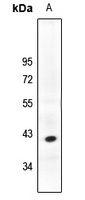 PHLDA1 antibody