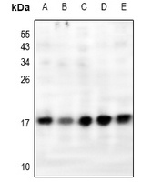 Anti-RPL31 Antibody