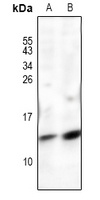 Anti-POLR2J Antibody