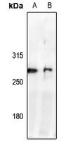 Anti-NAV2 Antibody