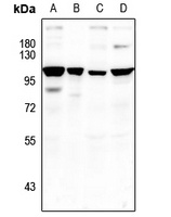 Anti-HELIOS Antibody