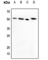 Anti-MMP1 Antibody
