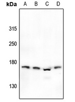 Anti-NMDAR2D Antibody