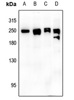 NEFH antibody