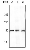 Anti-CD243 Antibody