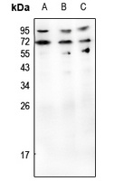 Anti-CD70 Antibody