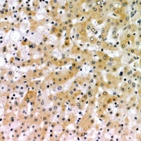 CD166 Rabbit Polyclonal Antibody