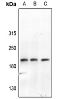 Anti-ABL1/2 (Phospho-Y393/439) Antibody
