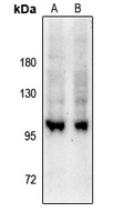 Anti-GEF H1 (Phospho-S885) Antibody