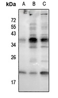 RAC1/2/3 (pS71) antibody