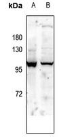 Anti-GLUR1 (Phospho-S863) Antibody