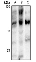 NFAT3 (pS168/S170) antibody