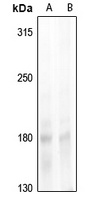NCOA1 (pT1179) antibody