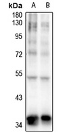Anti-TOB (Phospho-S164) Antibody
