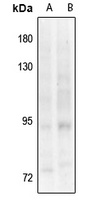 TRK B (pY817) antibody