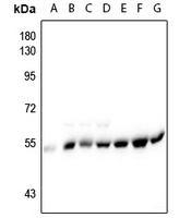 Anti-Alpha-tubulin (Phospho-Y272) Antibody