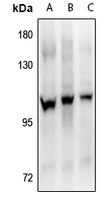 FGFR4 (pY642) antibody