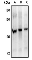 Anti-FGFR4 (Phospho-Y642) Antibody