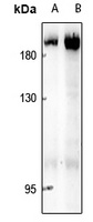 Anti-ABL1/2 Antibody