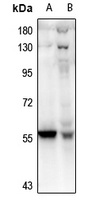 Anti-PFKFB2 Antibody