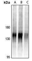 Anti-BCR Antibody