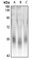 DAP Kinase 3 antibody