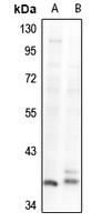 GNAZ antibody