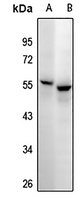 Anti-CD25 Antibody