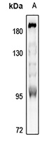 Anti-MUSK Antibody