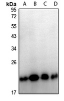 TPD52L2 antibody
