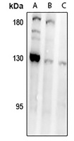 MAGEC1 antibody