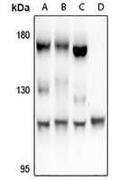 Anti-FARP2 Antibody