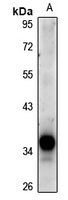 Anti-DCR3 Antibody