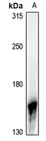 Anti-NGK Antibody