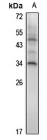 Anti-HOXA7 Antibody