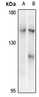 Anti-CIITA Antibody
