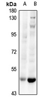 Anti-HLX Antibody