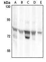 RhoBTB1 antibody