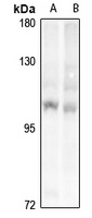 PRKD1/2/3 antibody