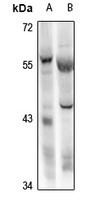 Anti-RBPJL Antibody