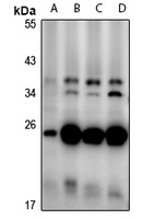 CD160 antibody