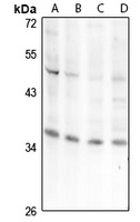 Aquaporin 5 antibody