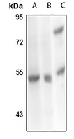 Anti-Carboxypeptidase M Antibody