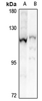 CHSY3 antibody