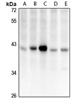 Anti-CCDC109A Antibody