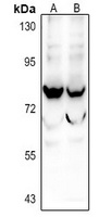 Anti-SIX5 Antibody