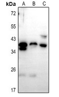 Anti-PTGR1 Antibody